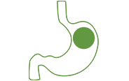 Gastric Balloon Procedure