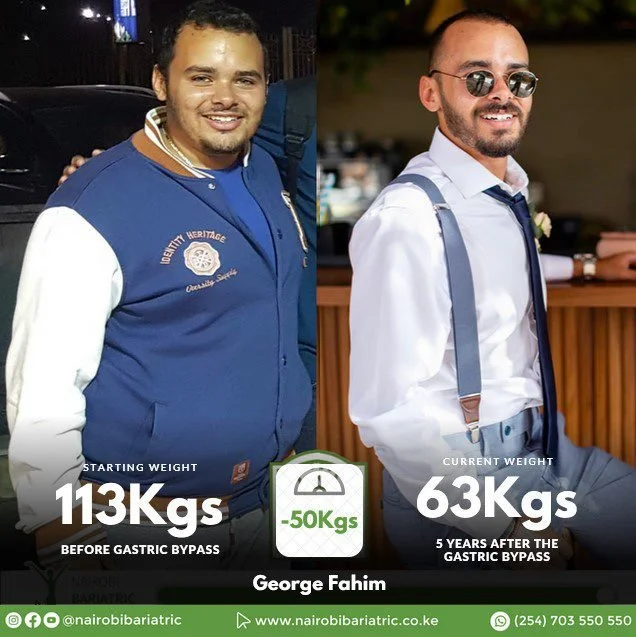 George Fahim Gastric Sleeve | Life-Changing Testimonial