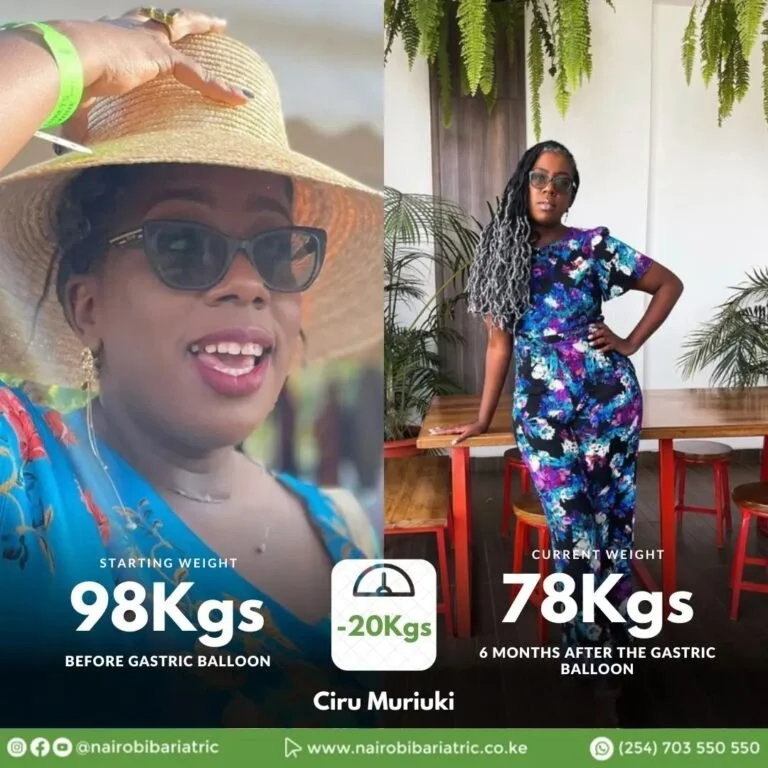 Ciru Muriuki Gastric Balloon | Real Transformation