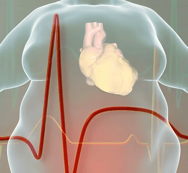 Obesity and Heart Disease | Lower Cardiac Risk by 30%