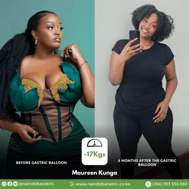 Maureen Kunga post-procedure result photo