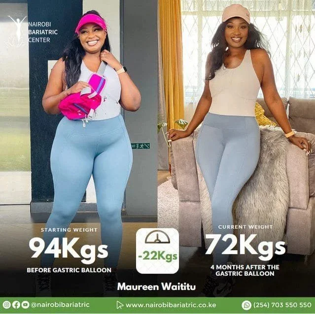 Maureen Waititu Gastric Balloon | Inspiring Testimonial