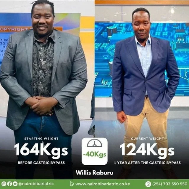 Willis-Raburu-nairobi-bariatric