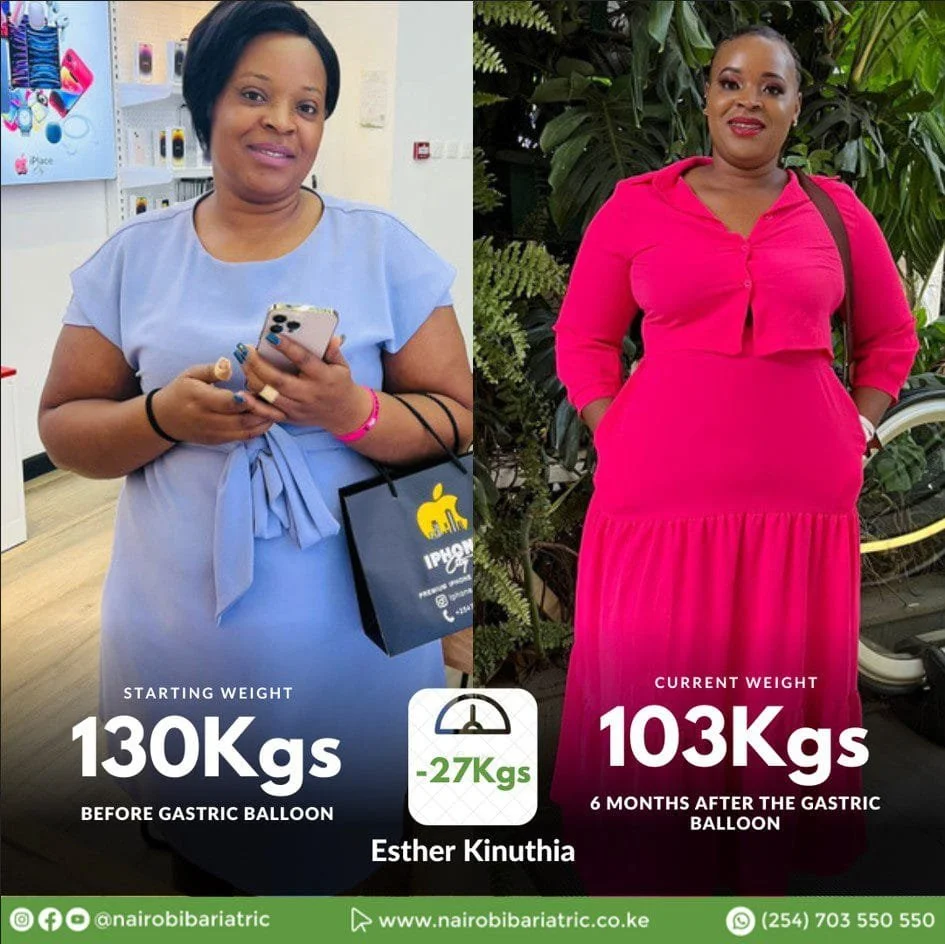 Esther Kinuthia consultation photo at Nairobi Bariatric Center