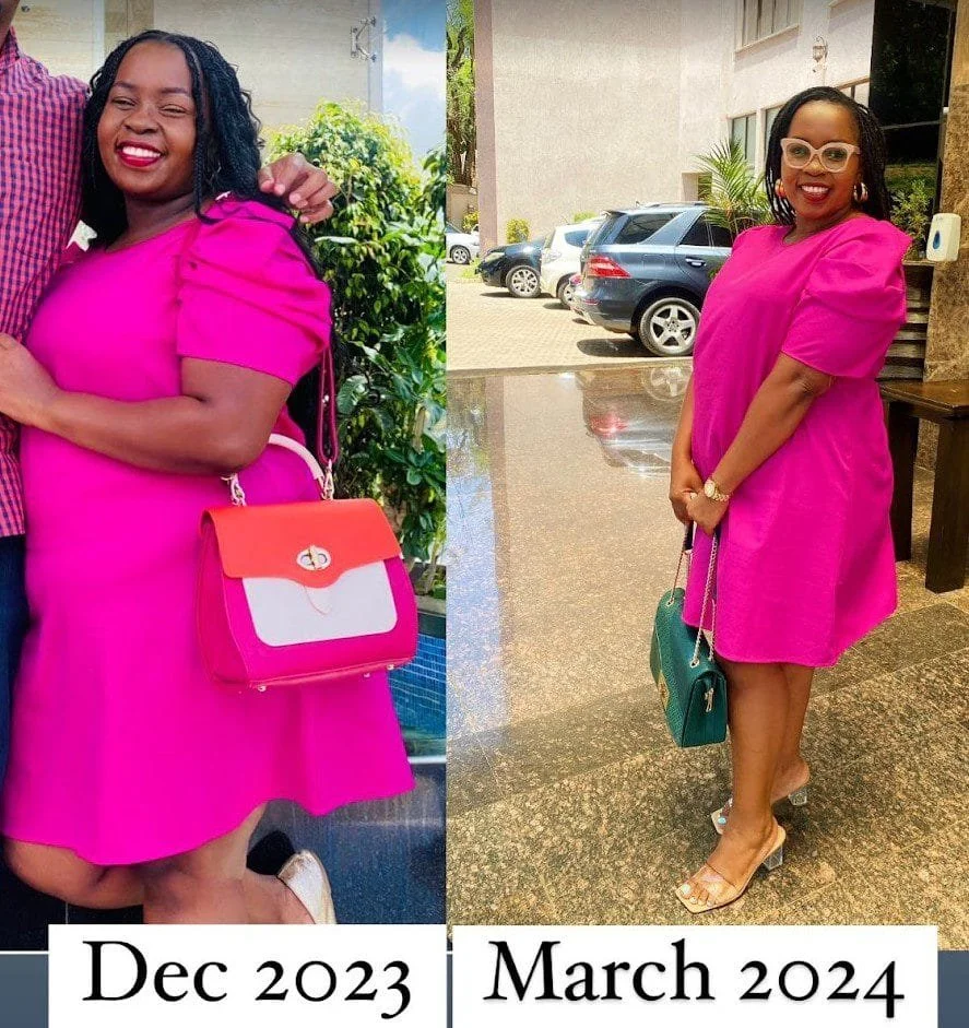 Julie_Kariuki_Gastric_sleeve