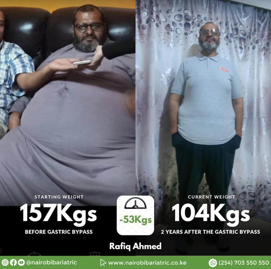 Rafiq_Ahmed_gastric_bypass