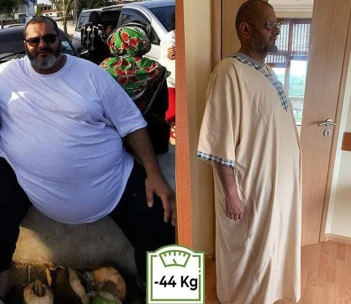 Rafiq_Ahmed_gastric_bypass