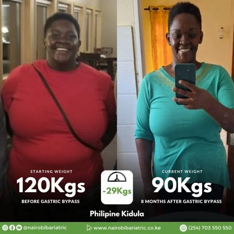 Philipine Kidula – Gastric Bypass Testimonial