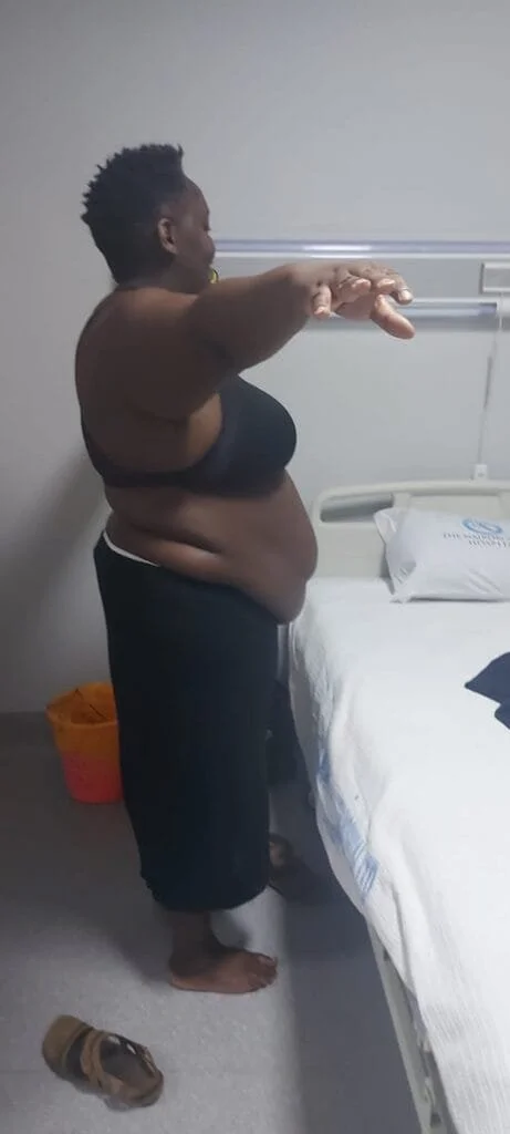 Philipine Kidula Gastric Bypass Testimonial