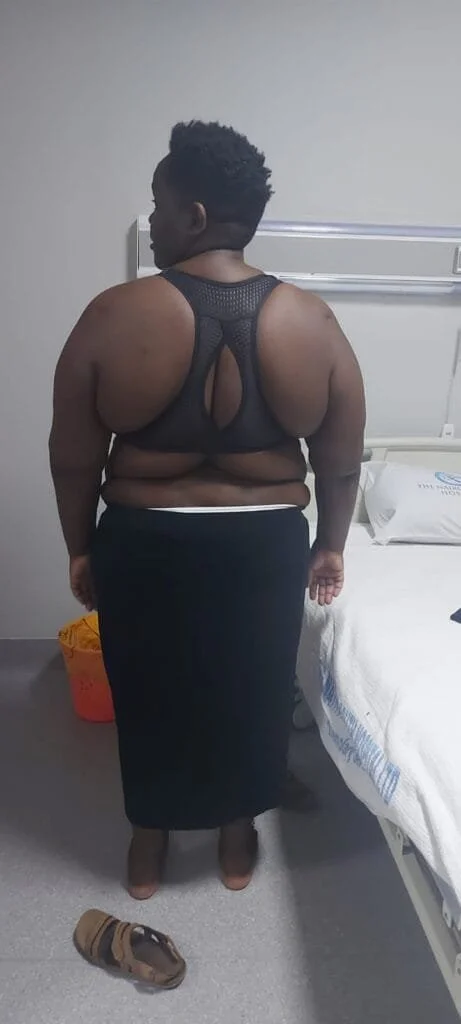 Philipine Kidula – Gastric Bypass Testimonial