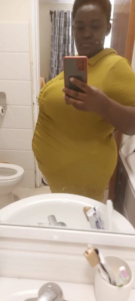 Philipine Kidula – Gastric Bypass Testimonial