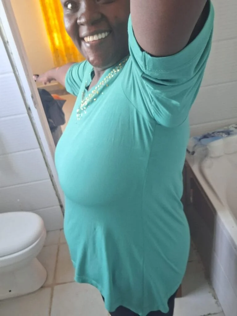 Philipine Kidula – Gastric Bypass Testimonial