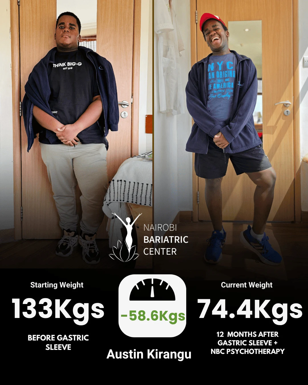 Austin Kirangu — Gastric Sleeve