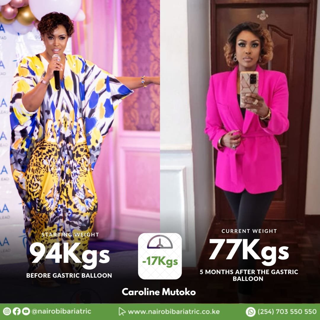 Caroline Mutoko — Gastric Balloon