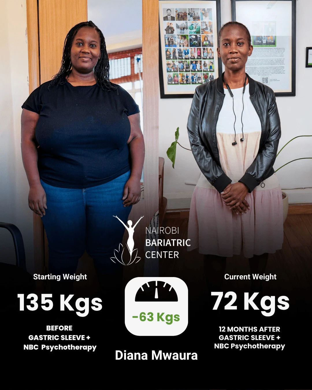Diana Mwaura — Gastric Sleeve