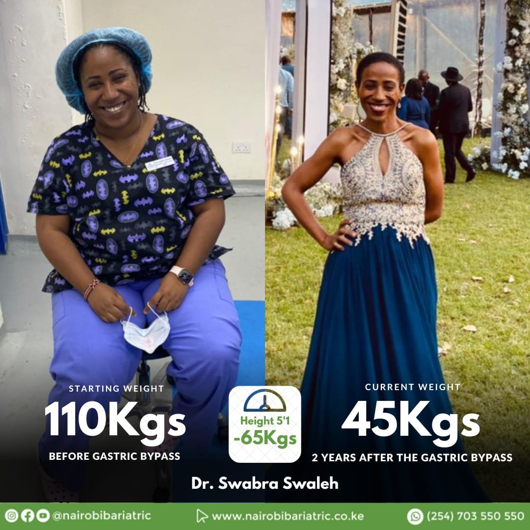 Dr. Swabra Swaleh — Gastric Bypass
