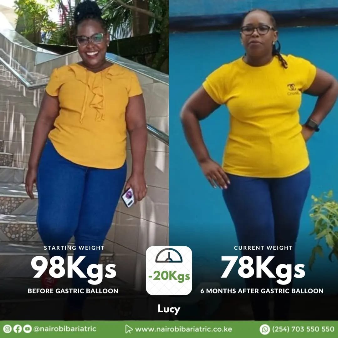Lucy — Gastric Balloon