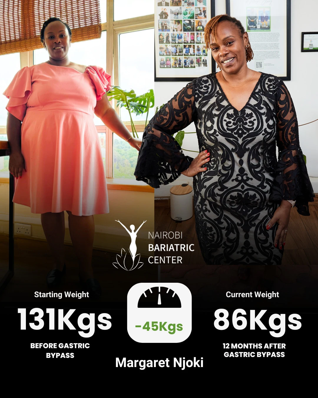 Margaret Njoki — Gastric Bypass