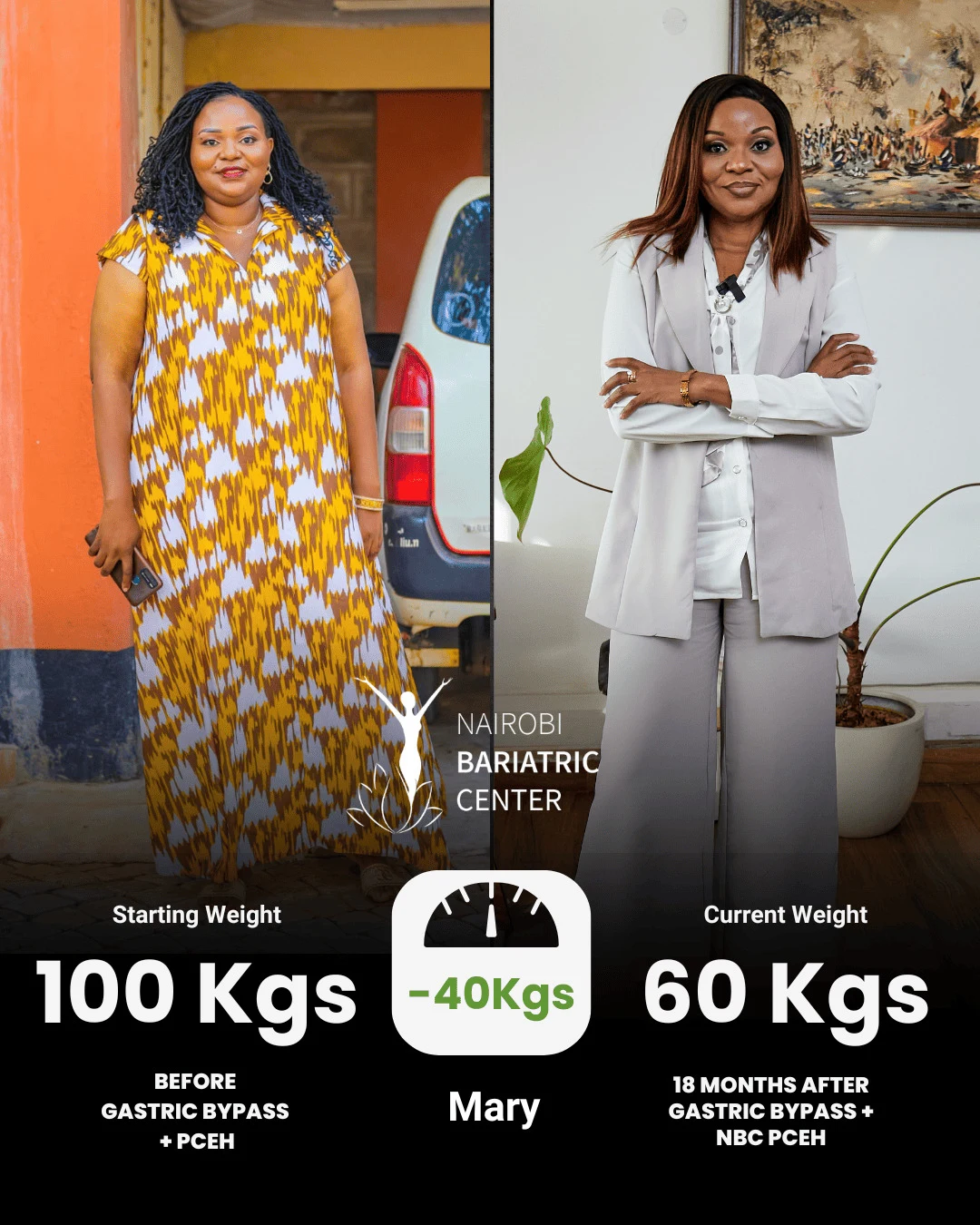Mary — Gastric Bypass