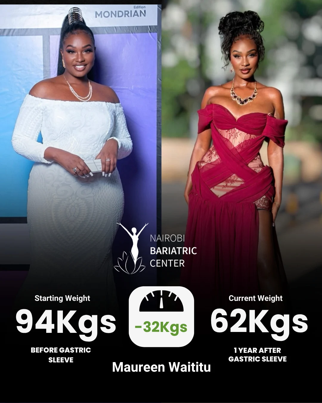 Maureen Waititu — Gastric Sleeve
