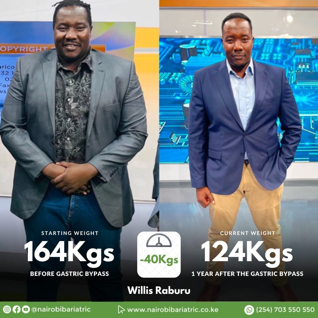 Willis Raburu — Gastric Bypass